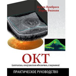 ОКТ сетчатка, сосудистая оболочка, глаукома. Практическое руководство