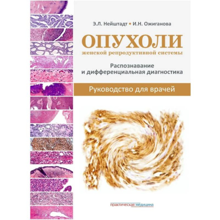 Здоровье, медицинская литература, книга Опухоли женской репродуктивной системы. Распознавание и дифференциальная диагностика. Руководство для врачей купить по скидке