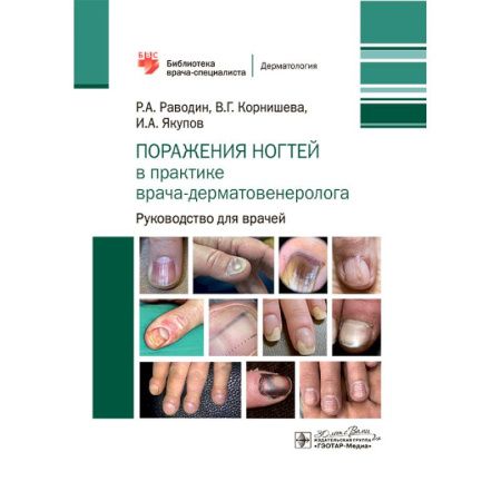 Медицинские энциклопедии и справочники, книга Поражения ногтей в практике врача-дерматовенеролога: руководство для врачей купить по скидке