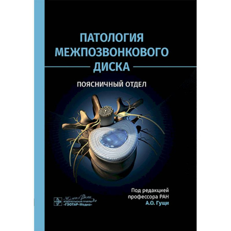 Здоровье, медицинская литература, книга Патология межпозвонкового диска. Поясничный отдел купить по скидке