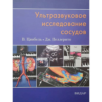 Ультразвуковое исследование сосудов