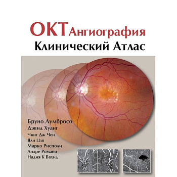 ОКТ-ангиография. Клинический атлас