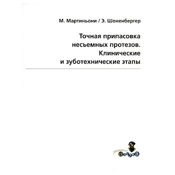 Точная припасовка несъемных протезов. Клинические и зуботехнические этапы